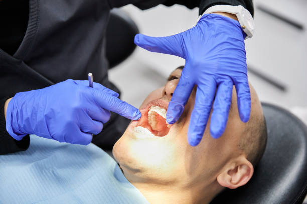 Best Emergency Wisdom Teeth Removal in Citrus Hills, FL